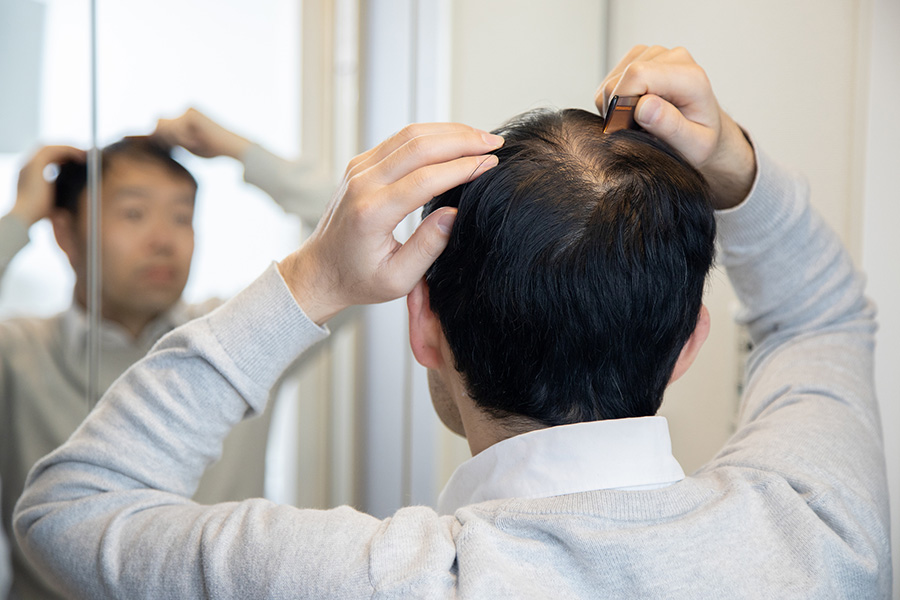 AGA治療イメージ